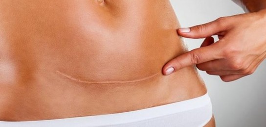 Жыныс мүшесі жартылай кесілген бейне