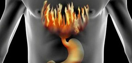 Тікелей секс шоу