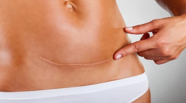 порно фото Муромцева Ирина